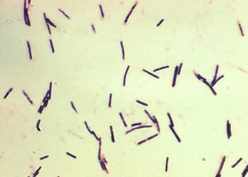北海道高中爆發魏氏梭菌感染 63名學生集體中毒
