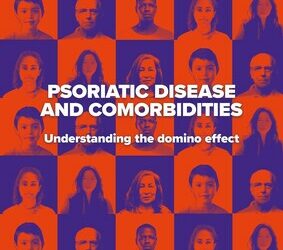 2025 年世界牛皮癬日:IFPA 呼籲停止牛皮癬的骨牌效應