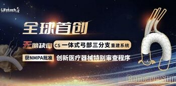 第17個創新綠色通道！先健CS一體式弓部三分支重建系統進入創新醫療器械特別審查程序